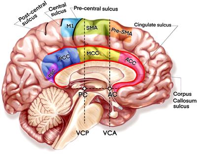Surgical techniques and function outcome for cingulate gyrus glioma, how we do it